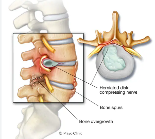 Surprising news from Ortho Doc – BionicOldGuy